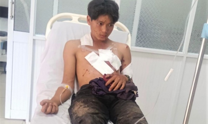 Nổ mìn tự chế khi đi đánh cá, 2 người bị đa chấn thương