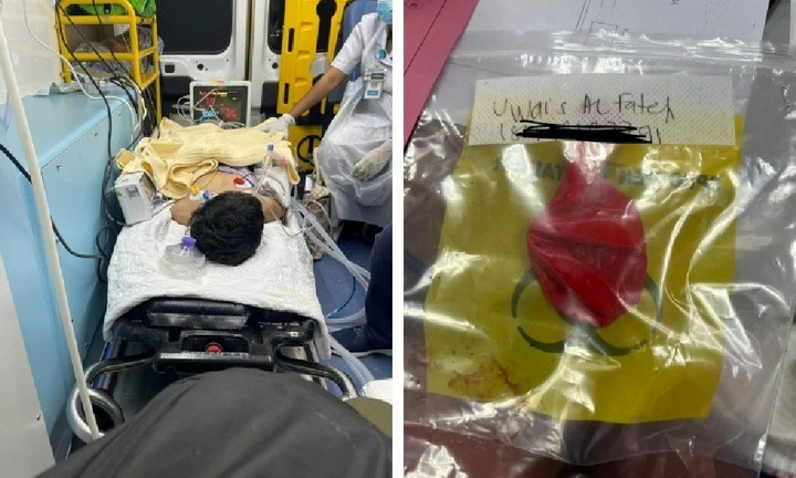 Bé trai ngừng tim ngay giữa tiệc sinh nhật vì hít phải quả bóng bay xì hơi