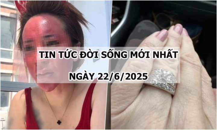Tin tức đời sống 22/6: Sốc trước khuôn mặt của người phụ nữ 22 năm không tẩy trang