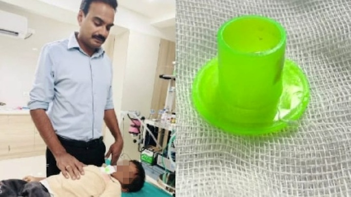 Đi khám đau họng, bé trai khiến bác sĩ 