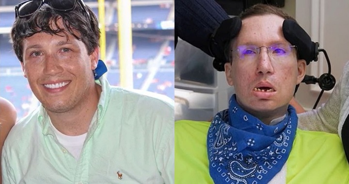 Nắn xương  điều chỉnh đốt sống cổ, nam thanh niên đột quỵ ở tuổi 24