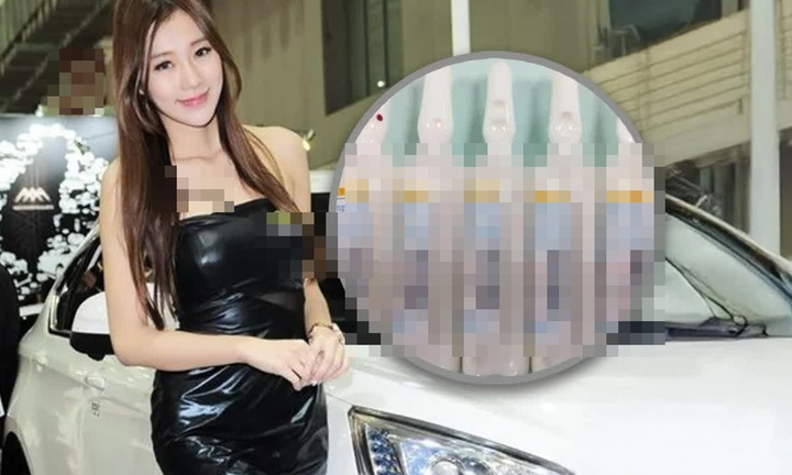 Người mẫu xe hơi nổi tiếng tử vong sau khi 