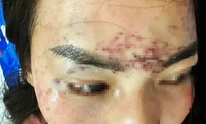 Thông tin mới nhất vụ nghi 