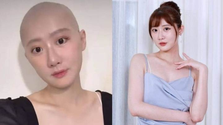 Mắc ung thư buồng trứng, nữ diễn viên trẻ chia sẻ đầy xót xa sau 6 lần hóa trị