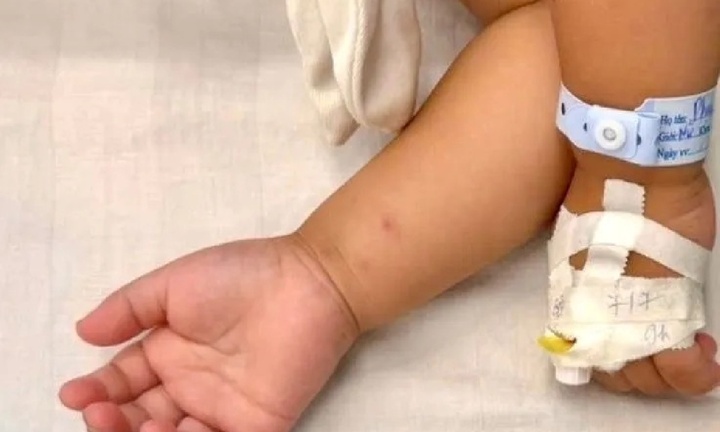Bé gái hơn 2 tuổi nhập viện cấp cứu vì uống nhầm thuốc diệt nấm