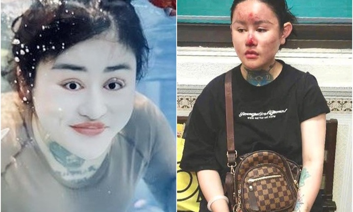 Vụ Ngân “Baby” bị tạm giữ vì phá ô tô, trụ ATM: 