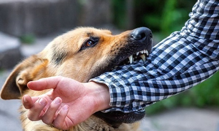 Xót xa: Nam sinh 13 tuổi tử vong sau nhiều lần bị chó cắn