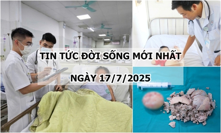 Tin tức đời sống 17/7: Bị sét đánh, người phụ nữ 55 tuổi chảy máu não