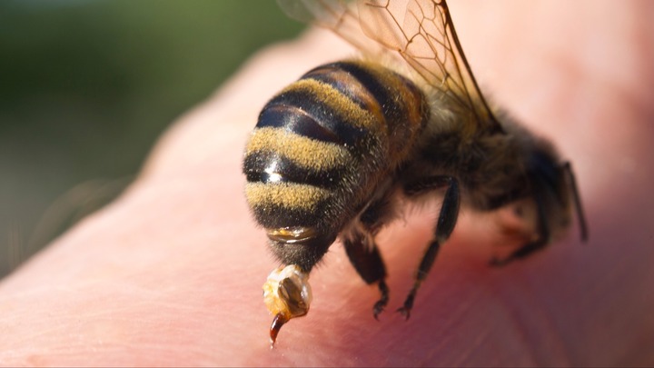 Người phụ nữ bị 70 con ong vò vẽ tấn công khi đang tập thể dục