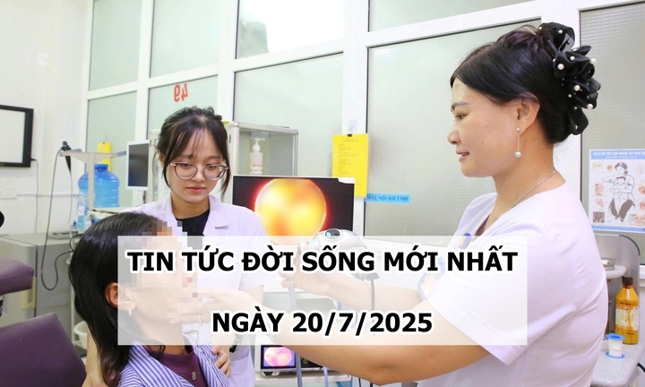 Tin tức đời sống 20/7: Hãi hùng phát hiện 7 con dòi trong mũi người phụ nữ