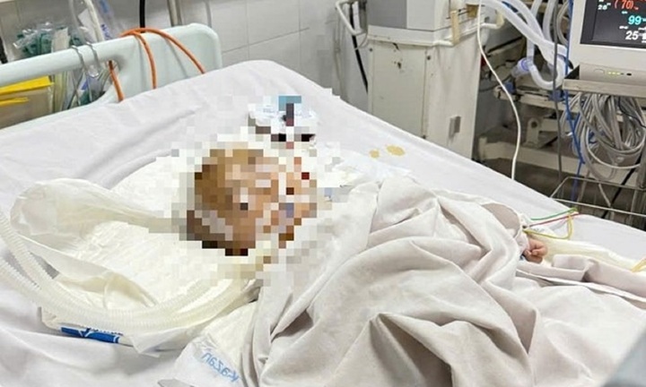 Vụ bé trai xuất huyết não bất thường tại điểm giữ trẻ tự phát tại Quảng Ngãi: Công an vào cuộc