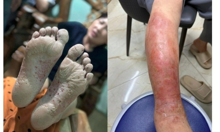 Nhiều bệnh nguy hiểm 