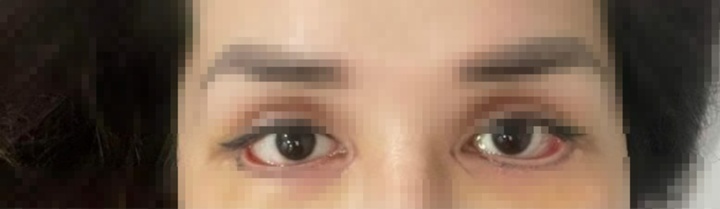 Bi hài hậu vận thẩm mỹ: Đu trend làm 