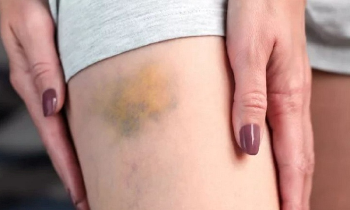 6 bất thường về ngoại hình cảnh báo gan đã quá tải