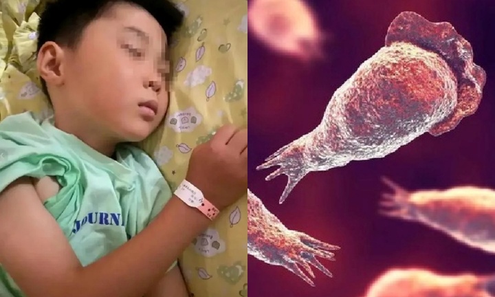 Bé trai 6 tuổi qua đời vì bệnh hiếm sau khi chơi té nước