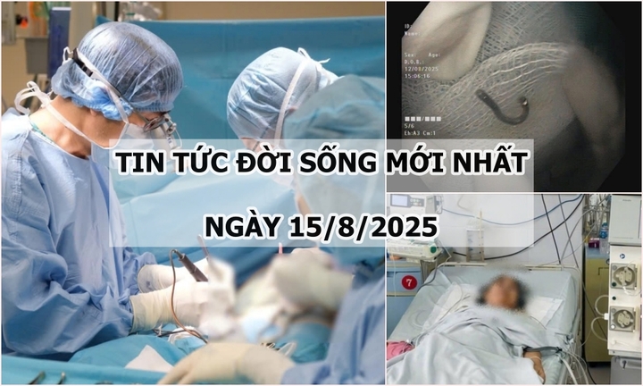 Tin tức đời sống 15/8: Phẫu thuật cho bệnh nhân ung thư có khối dị dạng mạch máu não “khổng lồ”