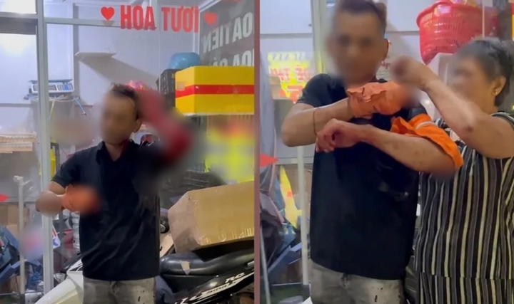 Điều tra vụ người đàn ông giữ xe tại quán nhậu ở TP.HCM bị chém trọng thương