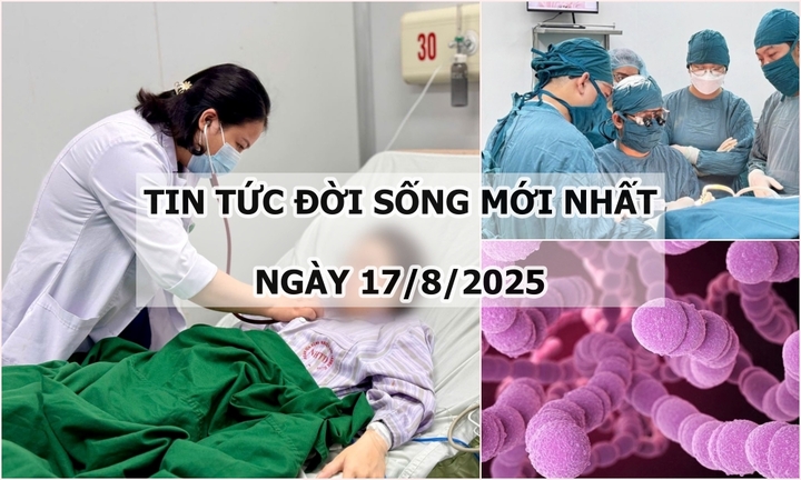 Tin tức đời sống 17/8: Bị đau đầu và buồn nôn, đi viện phát hiện nhiễm liên cầu lợn