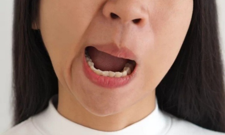 Đừng làm ngơ trước những dấu hiệu cảnh báo nguy cơ đột quỵ này vào buổi sáng kẻo hối tiếc không kịp