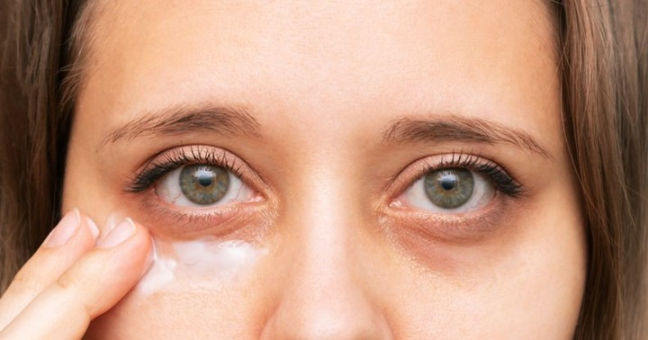 5 dấu hiệu trên mặt cảnh bệnh thận