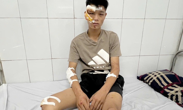 Clip: Chi tiết lời khai của đối tượng lái xe 