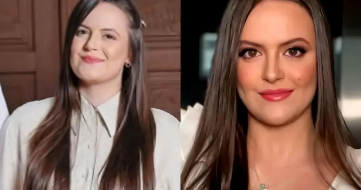 Thương tâm: Cô gái 22 tuổi Brazil tử vong sau khi chụp CT