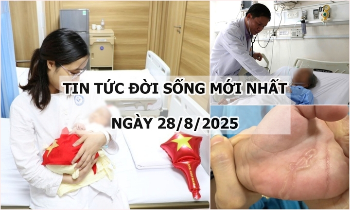 Tin tức đời sống 28/8: Nguyên nhân tay bé trai 4 tuổi xuất hiện vết ngoằn ngoèo bất thường