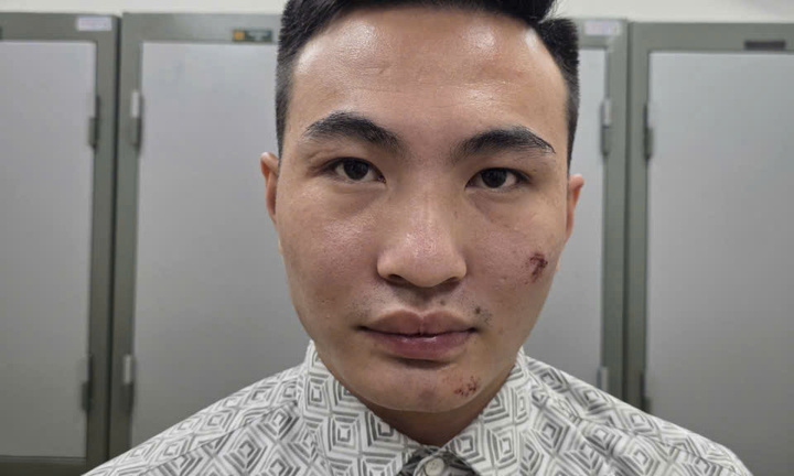 Tạm giữ hình sự đối tượng vi phạm giao thông, chống người thi hành công vụ tại chốt bảo vệ A80