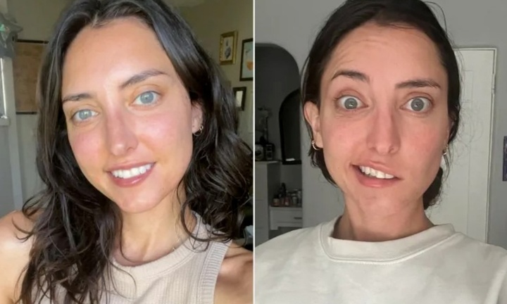 Diễn viên nổi tiếng liệt nửa mặt, khởi đầu từ cảm giác tê lạ ở lưỡi