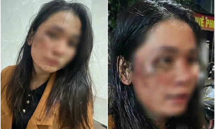 Xác minh vụ nữ nhân viên giao hàng tố bị khách hành hung vì đơn hàng 900 nghìn