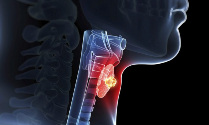 Tin tức đời sống 22/9: Đi khám định kỳ, hai vợ chồng phát hiện cùng mắc một loại ung thư