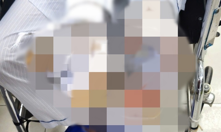 Bị chó nhà nặng 30kg tấn công, cụ bà phải nhập viện cấp cứu