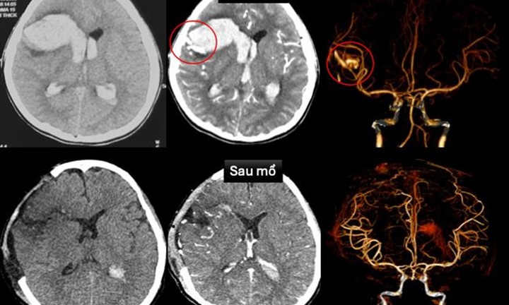 Tin tức đời sống 5/11: Bé gái đang ngủ bỗng khó thở, rơi vào hôn mê nguy kịch