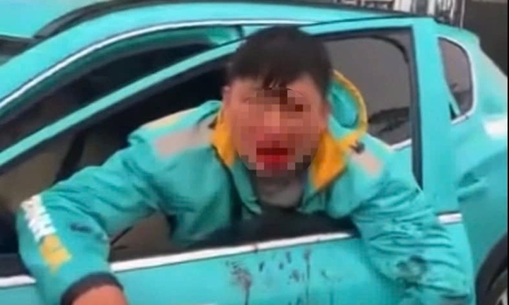 Vụ tài xế xe ôm công nghệ bị đánh thương tích ở Hà Nội: Hé lộ nguyên nhân