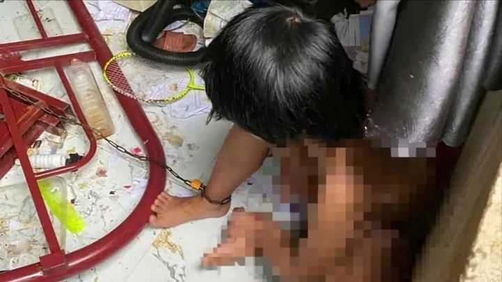 Xác minh vụ bé gái 9 tuổi bị bố xích chân trong phòng