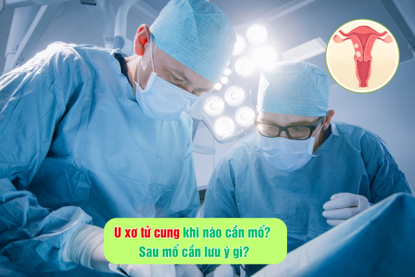 U xơ tử cung khi nào cần mổ? Sau mổ cần lưu ý gì?