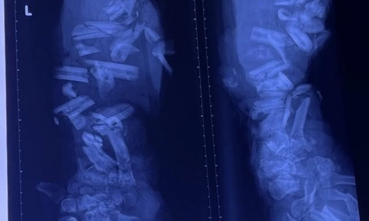 Tin tức đời sống 14/12: Công nhân bị máy nghiền vỏ dừa cán dập cánh tay