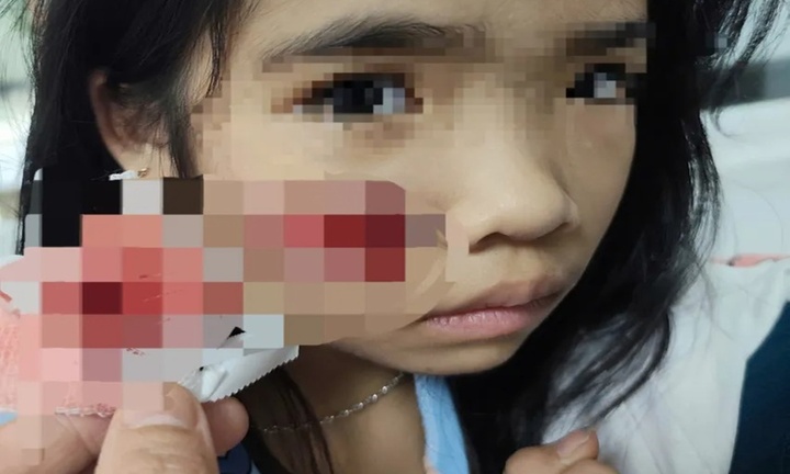 Bé gái đang chơi ở sân nhà bị khỉ hoang lao vào tấn công