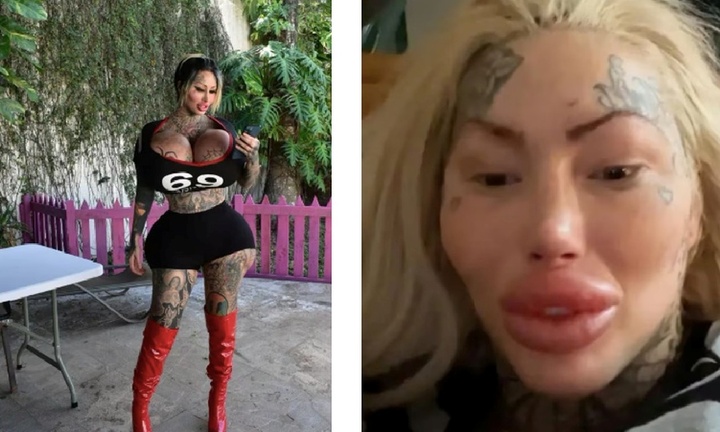 Nữ người mẫu nghiện 