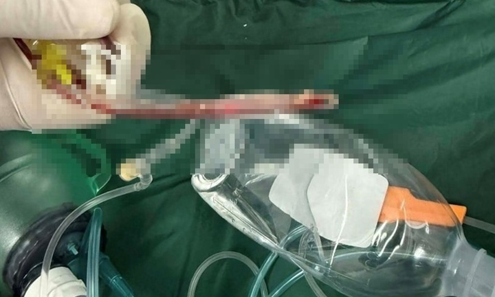 Vụ trẻ 3 tuổi tử vong chưa rõ nguyên nhân ở lớp mẫu giáo: Tình tiết mới nhất