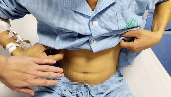 Người đàn ông suýt thiệt mạng vì nuốt mật cá trắm để 