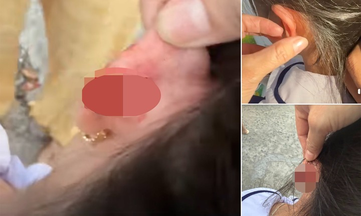 Vụ phụ huynh phản ánh giáo viên véo tai học sinh lớp 1 chảy máu: Nhà trường báo cáo gì?