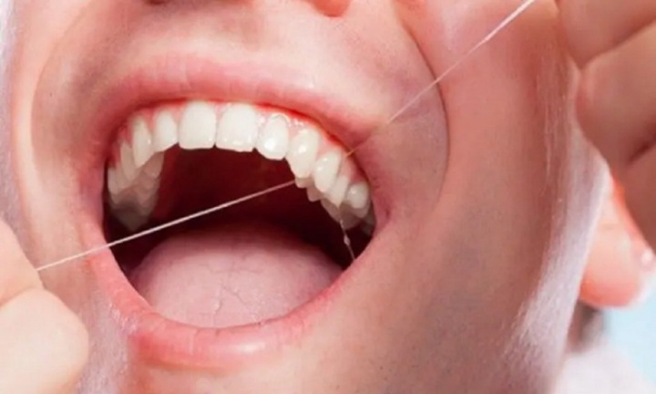 Thói quen giúp giảm nguy cơ đột quỵ