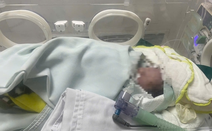 Trẻ sơ sinh bị bỏ rơi đã ngừng tim, người đầy bùn đất được 