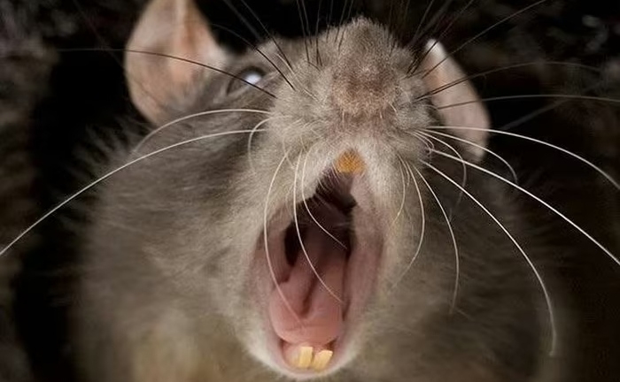 Chủ quan từ vết chuột cắn, thiếu niên 16 tuổi mắc bệnh nhiễm trùng nguy hiểm