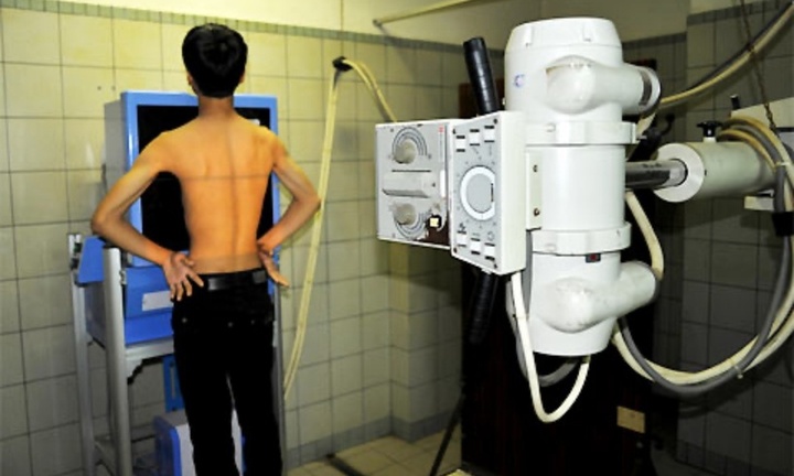 Bộ Y tế: Không lấy “thời gian chụp chiếu” làm căn cứ từ chối thanh toán BHYT