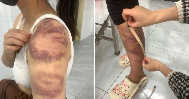 Tạm giữ người đàn ông nhiều lần trói, đánh con gái 13 tuổi và vợ đang mang thai