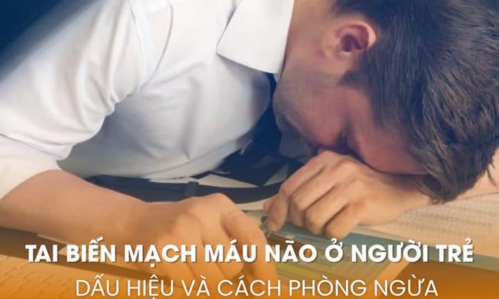 Tai biến mạch máu não ở người trẻ: Dấu hiệu và cách phòng ngừa