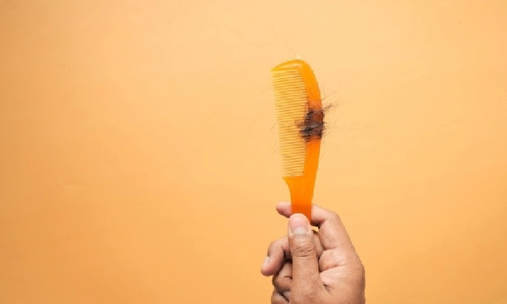 Mẹ rụng tóc, xuất hiện mảng hói to bằng bàn tay vì áp lực dạy con học bài