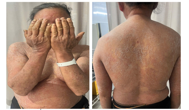 Sử dụng nhiều loại thuốc bôi mua qua mạng, người phụ nữ lãnh hậu quả